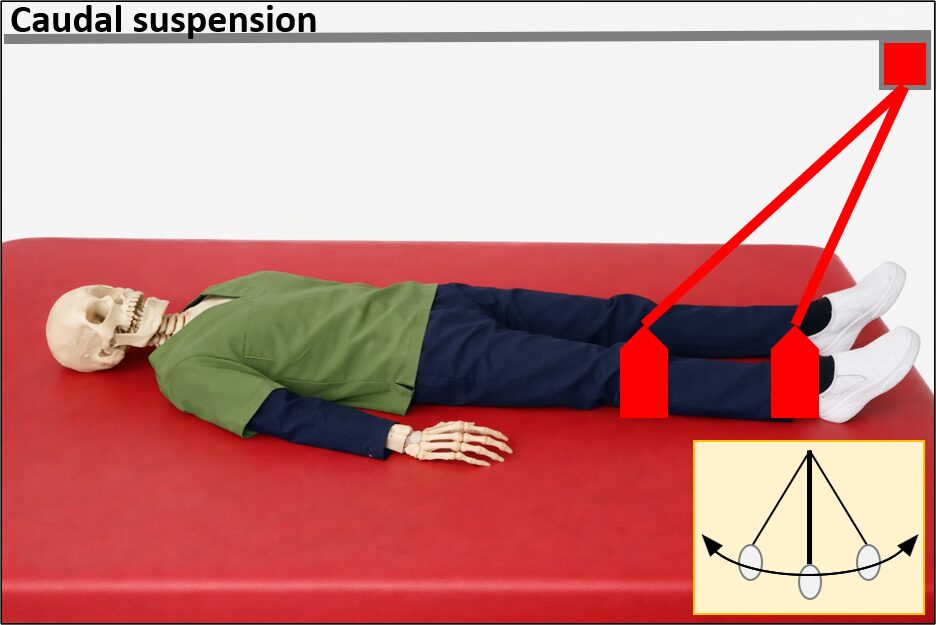 Caudal suspensionの画像